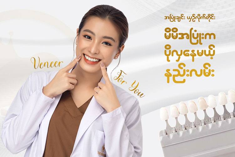 သွားကြွေလွှာကပ်ခြင်း ( Aesthetic Veneer )