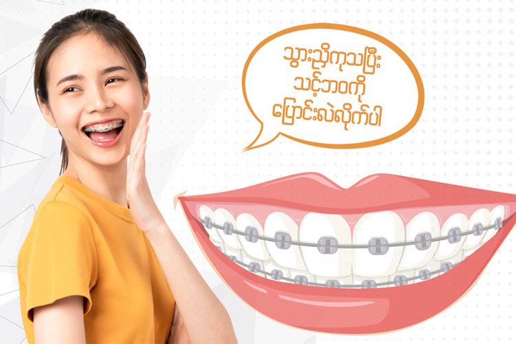 သွားညှိခြင်း ( Ortho by Metal Brace ) 