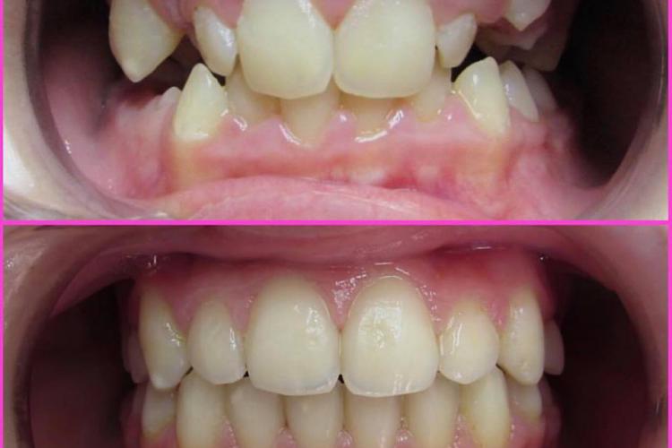 The Grand Family Dental | Orthodontist