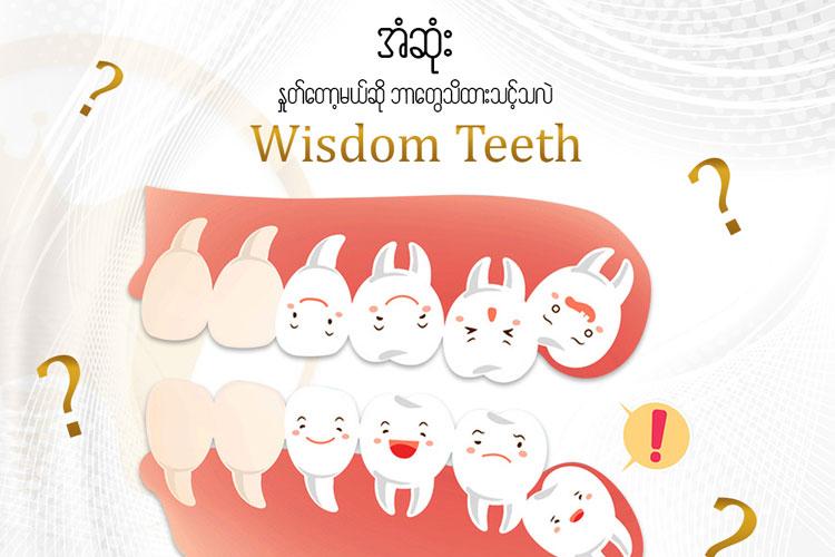 အံဆုံး ( Wisdom Teeth ) ပေါက်ခြင်းအကြောင်း သိကောင်းစရာ။