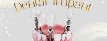 Dental Implant