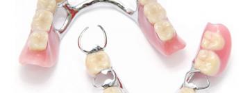 သတ္တု သွားအံကပ်လုပ်ခြင်း ( Metallic Denture )